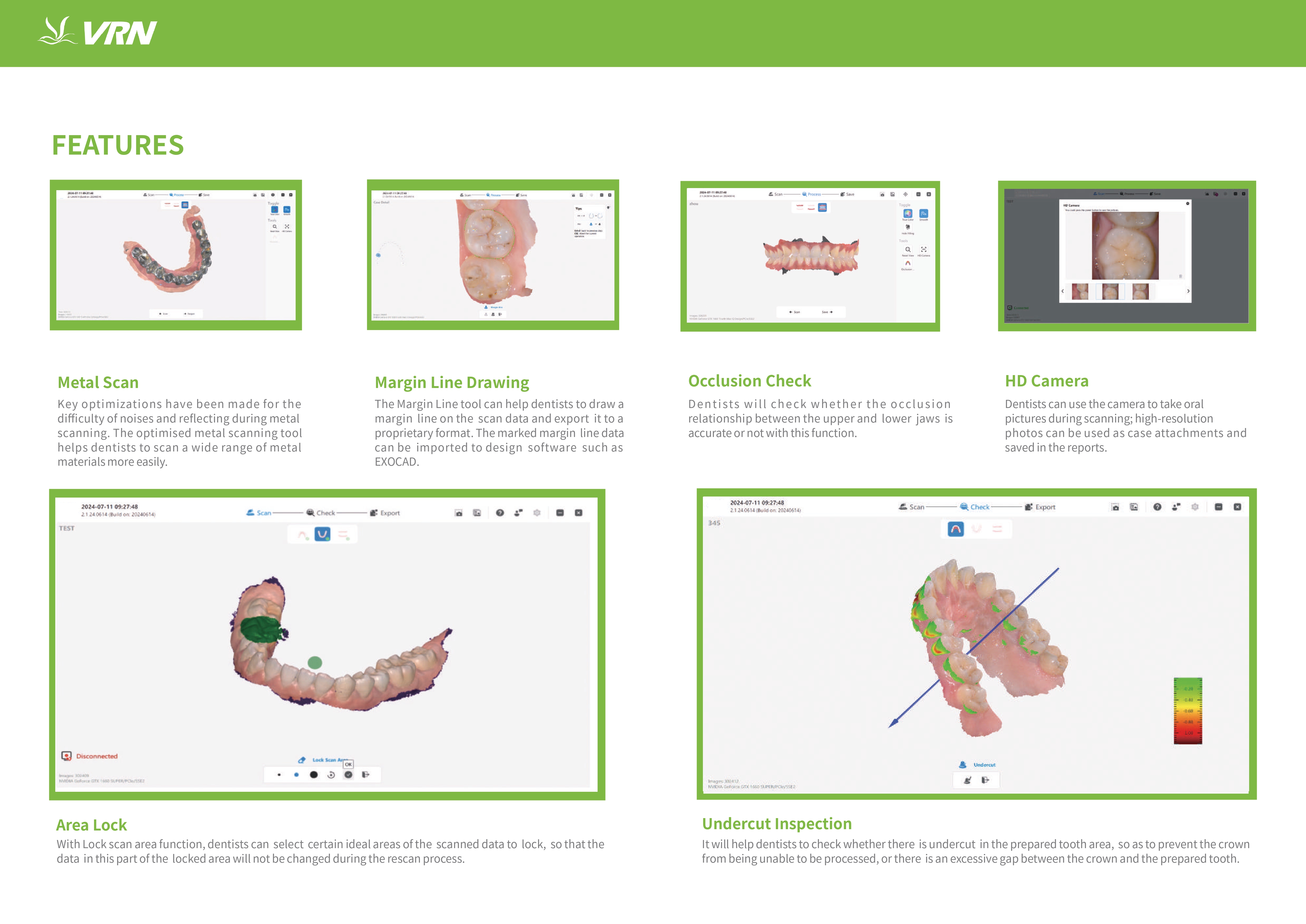 口腔掃描儀-新產(chǎn)品_維潤(rùn)-20250408_compressed (1)_page-0004.jpg